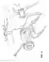 Fig. 04 - Roping training device