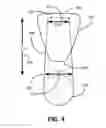 Fig. 06 - Rectocele and cystocele device