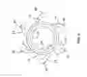Fig. 07 - Friction reducing downhole assemblies
