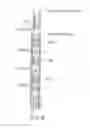 Fig. 08 - Method and apparatus for stimulating a geothermal well