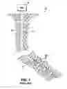 Fig. 02 - Apparatus and methods for well control