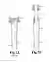 Fig. 08 - Two-piece connection lift system and method