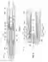 Fig. 08 - Underreamer for increasing a wellbore diameter