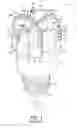 Fig. 02 - Cutting structures for fixed cutter drill bit and other downhole cutting tools