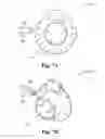 Fig. 09 - Braking device, system and method