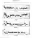 Fig. 08 - Cannulas, Collars for Implantable Devices, and Corresponding Systems and Methods