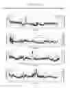 Fig. 09 - Cannulas, Collars for Implantable Devices, and Corresponding Systems and Methods