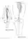 Fig. 02 - Blow-molded package for a catheter