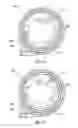 Fig. 08 - Blow-molded package for a catheter