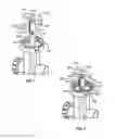 Fig. 09 - Vertical slide backwash valve