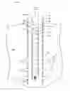 Fig. 01 - CHEMICAL STRAINER