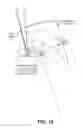 Fig. 10 - Lifting systems