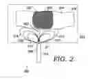 Fig. 04 - Customized microwave energy distribution utilizing slotted cage