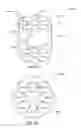 Fig. 16 - Waste disposal apparatus
