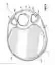 Fig. 03 - Stable and Stackable Tray with Receptacle for Beverage Container and Thumbholds for Secure Grip