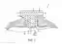 Fig. 03 - Sealing assemblies and pressurized fluid vessels including the sealing assemblies