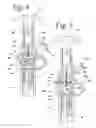 Fig. 03 - Vacuum bottle stopper for wine and method