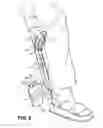 Fig. 08 - Long handled sock donning tool and method of use
