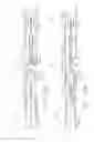 Fig. 22 - Drive system lockout arrangements for modular surgical instruments