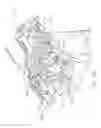 Fig. 85 - Drive system lockout arrangements for modular surgical instruments