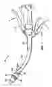 Fig. 02 - Vacuum assisted surgical stapler