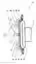 Fig. 01 - Pinch valve