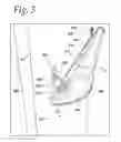 Fig. 03 - Handrail apparatus for use with vehicles