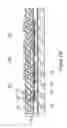 Fig. 08 - MEMS pressure sensor and microphone devices having through-vias and methods of forming same
