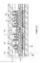 Fig. 29 - MEMS pressure sensor and microphone devices having through-vias and methods of forming same