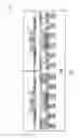 Fig. 08 - Package on-package structure