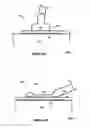 Fig. 02 - SUPPLEMENTING WIRE BONDS