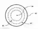 Fig. 01 - Corneal implant systems and methods
