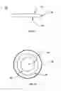 Fig. 02 - Corneal implant systems and methods