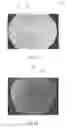 Fig. 09 - Thin-walled implant structures and related methods
