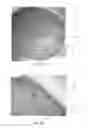 Fig. 16 - Thin-walled implant structures and related methods