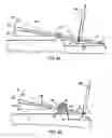 Fig. 09 - Negative spring compensation for elastomeric bearing torque