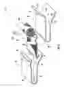 Fig. 04 - Seals for a gas turbine engine