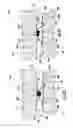 Fig. 16 - Seals for a gas turbine engine