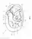 Fig. 09 - Airbag with deflector