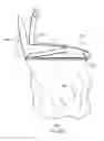 Fig. 33 - WASTE PICK-UP AND STORAGE DEVICE