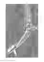Fig. 40 - MEDICAL SUPPORT APPARATUS