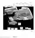 Fig. 55 - MEDICAL SUPPORT APPARATUS
