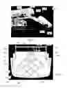 Fig. 56 - MEDICAL SUPPORT APPARATUS