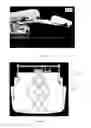 Fig. 57 - MEDICAL SUPPORT APPARATUS