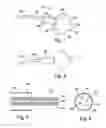 Fig. 02 - ACCELEROMETER