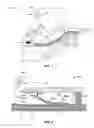 Fig. 02 - Micro-plasma generation using micro-springs