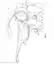 Fig. 06 - Head mounted display with non-pupil forming optical path