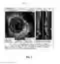 Fig. 07 - TOMOGRAPHIC IMAGING SYSTEM WITH INTEGRATED MICROSURGERY STABILIZATION TOOL