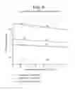 Fig. 07 - Presbyopia lens with pupil size correction based on level of refractive error