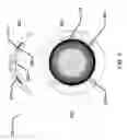 Fig. 04 - Methods and apparatus to form ophthalmic devices incorporating photonic elements